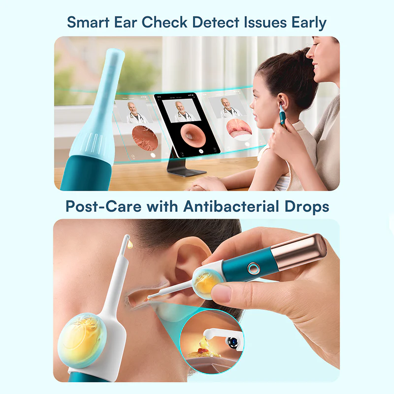 Sakerplus® Ear Wax Removal Tool Camera - Image 8
